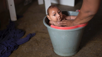 Biến chứng nguy hiểm của virus Zika là gây teo não và rối loạn hệ thống miễn dịch tácd dộng đến thần kinh.