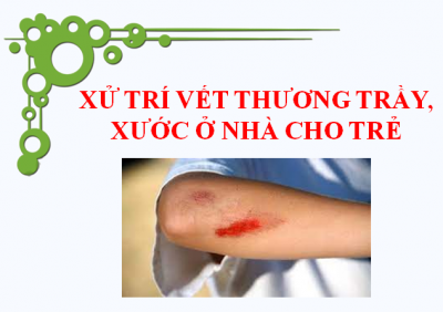 Xử lý vết thương trầy xước cho trẻ ở nhà